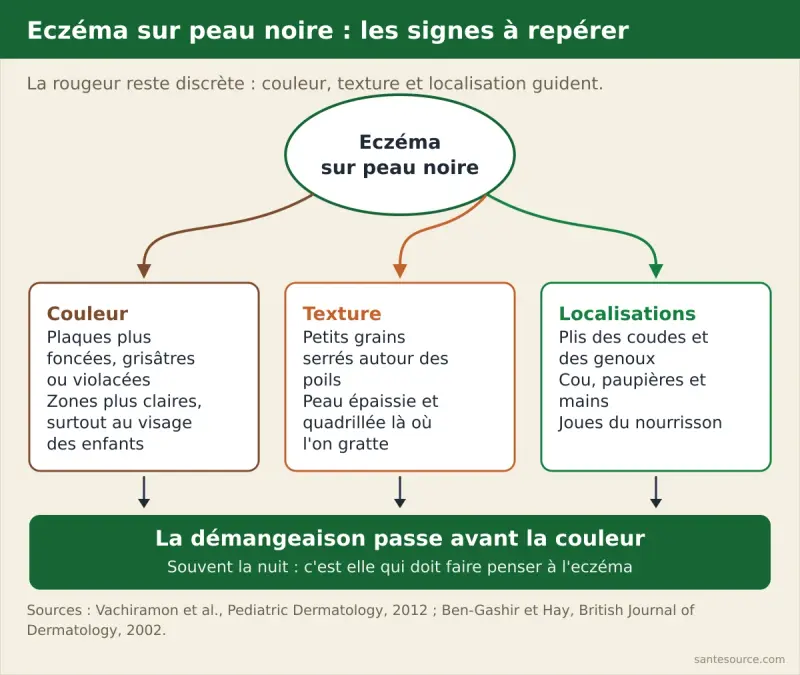 Schéma des signes de l'eczéma sur peau noire : plaques foncées ou grisâtres, grains autour des poils, peau épaissie, zones plus claires et localisations aux plis, au cou et aux mains